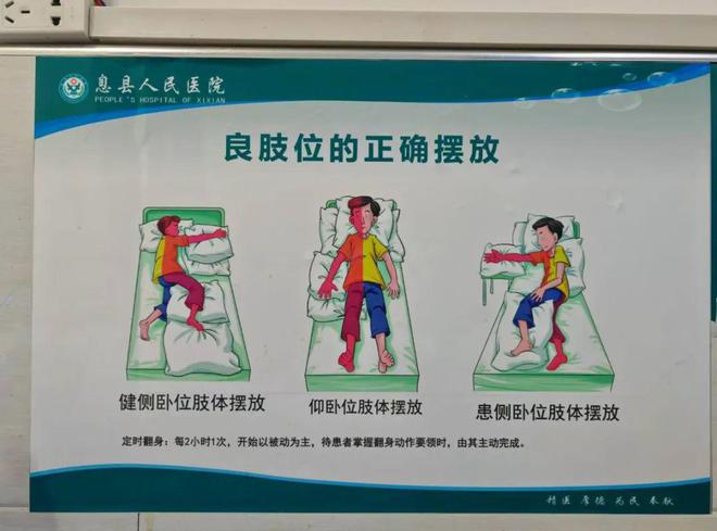 MK体育息县人民医院神经内科一病区“一科一品”优质护理服务(图1)