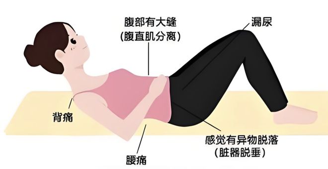 MK体育文献解读 产后盆底康复措施及实施方案 -针对性的治疗方法(图2)