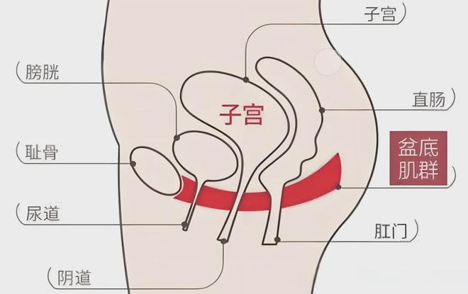 MK体育文献解读 产后盆底康复措施及实施方案 -针对性的治疗方法(图11)
