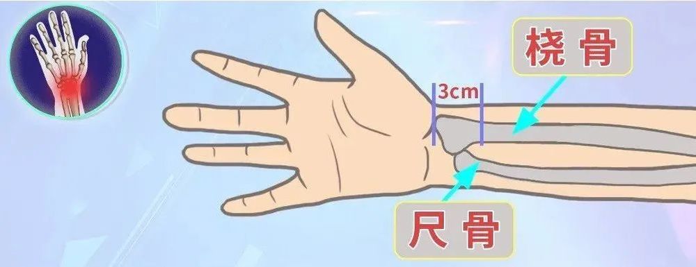 MK体育年仅22岁！小伙摔倒以为没事7天后死亡！(图5)