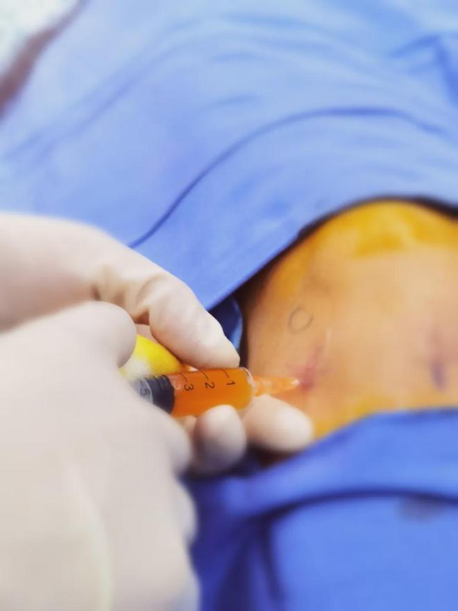 MK体育膝关节术后运动康复指南：科学锻炼重启灵活人生(图8)