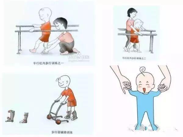 MK体育脑瘫康复训练根据小儿运动发育顺序图文讲解(图6)