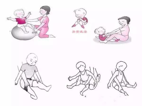 MK体育脑瘫康复训练根据小儿运动发育顺序图文讲解(图3)